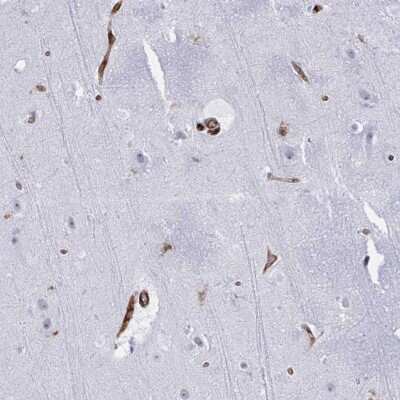 Immunohistochemistry: EML1 Antibody [NBP2-38601] - Staining of human cerebral cortex shows strong cytoplasmic positivity in endothelial cells.