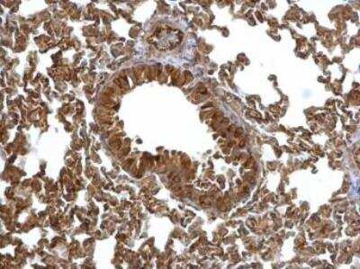 Immunohistochemistry-Paraffin: EML1 Antibody [NBP1-30956] - Mouse lung. EML1 antibody [C3], C-term dilution: 1:500. Antigen Retrieval: Trilogy™ (EDTA based, pH 8.0) buffer, 15min.