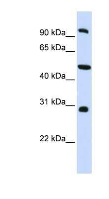 Western Blot: EML1 Antibody [NBP1-56595] - HepG2 cell lysate, concentration 0.2-1 ug/ml.