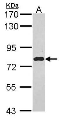 Western Blot: EML1 Antibody [NBP2-16327] - Sample (30 ug of whole cell lysate) A: Hep G2 7. 5% SDS PAGE gel, diluted at 1:1000.