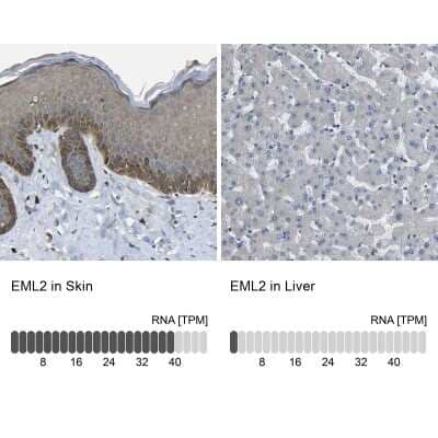 Immunohistochemistry-Paraffin EML2 Antibody