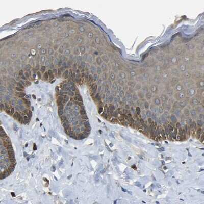 Immunohistochemistry-Paraffin EML2 Antibody