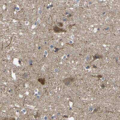 Immunohistochemistry-Paraffin EML2 Antibody