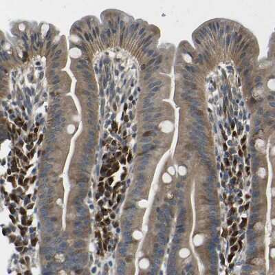 Immunohistochemistry-Paraffin: EML2 Antibody [NBP1-84861] - Staining of human duodenum shows strong cytoplasmic positivity in lymphoid cells.