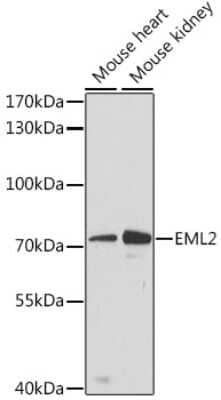 Western Blot: EML2 Antibody [NBP3-04734] - Analysis of extracts of various cell lines, using EML2 antibody at 1:3000 dilution. Secondary antibody: HRP Goat Anti-Rabbit IgG (H+L) at 1:10000 dilution. Lysates/proteins: 25ug per lane. Blocking buffer: 3% nonfat dry milk in TBST. Detection: ECL Basic Kit