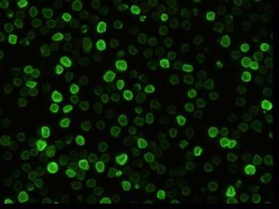 Immunocytochemistry/Immunofluorescence: EMMPRIN/CD147 Antibody (041) [NBP2-90540] - Immunofluorescence staining of Mouse EMMPRIN/CD147 in Mouse Spleen cells. Cells were fixed with 4% PFA, blocked with 10% serum, and incubated with rabbit anti-mouse EMMPRIN/CD147 monoclonal antibody (1:60) at 37C 1 hour. Then cells were stained with the Alexa Fluor(R) 488-conjugated Goat Anti-rabbit IgG Secondary antibody (green). Positive staining was localized to cell membrane.