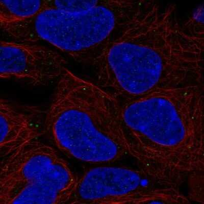 Immunocytochemistry/Immunofluorescence: EMMPRIN/CD147 Antibody [NBP2-57810] - Staining of human cell line HEK 293 shows localization to vesicles.