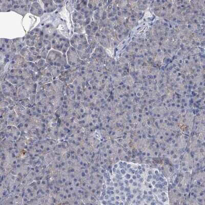 Immunohistochemistry-Paraffin: EMMPRIN/CD147 Antibody [NBP2-34025] - Staining of human pancreas shows low expression as expected.