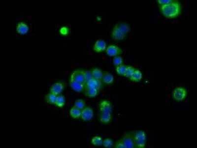 Immunocytochemistry/Immunofluorescence: EMMPRIN/CD147 Antibody (OTI9H5) - Azide and BSA Free [NBP2-70278] - Staining of HT29 cells using anti-CD147 mouse monoclonal antibody.