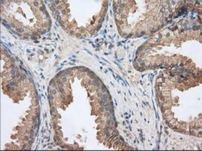 Immunohistochemistry: EMMPRIN/CD147 Antibody (OTI9H5) - Azide and BSA Free [NBP2-70278] - Staining of paraffin-embedded Human prostate tissue using anti-CD147 mouse monoclonal antibody.