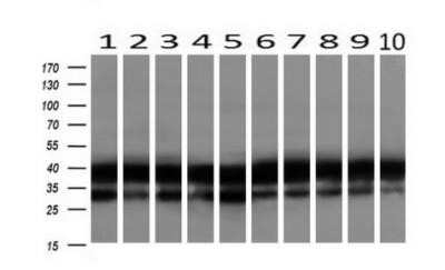 Western Blot: EMMPRIN/CD147 Antibody (OTI9H5) - Azide and BSA Free [NBP2-70278] - Analysis of extracts (10ug) from 10 Human tissue by using anti-BSG monoclonal antibody at 1:500 (1: Testis; 2: Omentum; 3: Uterus; 4: Breast; 5: Brain; 6: Liver; 7: Ovary; 8: Thyroid gland; 9: colon;10: spleen).