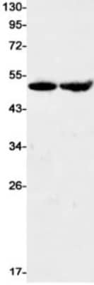 Western Blot: EMMPRIN/CD147 Antibody (S04-5B3) [NBP3-20062] - Western blot detection of EMMPRIN/CD147 in Hela (Lane 1), Ramos (Lane 2) cell lysates using NBP3-20062 (1:1000 diluted). Predicted band size: 42kDa. Observed band size: 42kDa.
