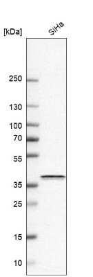 Western Blot: EMMPRIN/CD147 Antibody [NBP2-57810] - Analysis in human cell line SiHa.