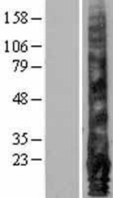 Western Blot: EMP1 Overexpression Lysate (Adult Normal) [NBL1-10259] Left-Empty vector transfected control cell lysate (HEK293 cell lysate); Right -Over-expression Lysate for EMP1.