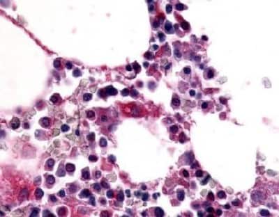 Immunohistochemistry-Paraffin: EMR1 Antibody [NLS1180] - Analysis of anti-EMR1 / F4/80 antibody with human bone marrow at 18 ug/ ml.