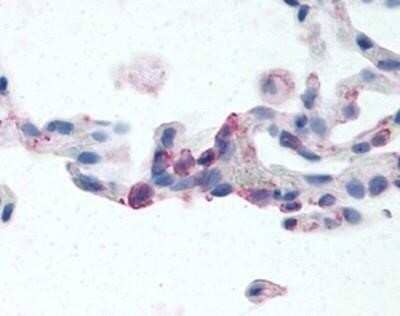 Immunohistochemistry-Paraffin: EMR2 Antibody - BSA Free [NBP1-02661] - Staining of human lung, neutrophils. Immunohistochemistry of formalin-fixed, paraffin-embedded tissue after heat-induced antigen retrieval. Antibody concentration 24 ug/ml.