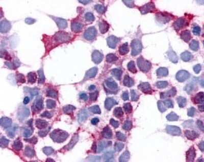 Immunohistochemistry: EMR2 Antibody [NLS1663] - Analysis of anti-EMR2 antibody with transfection positive.