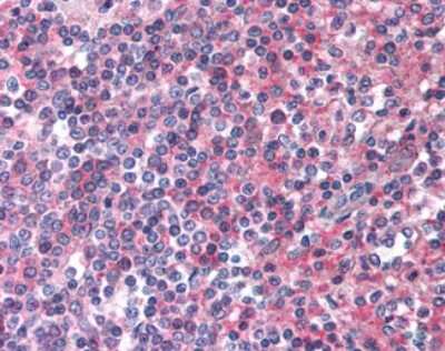 Immunohistochemistry-Paraffin EMR2 Antibody - BSA Free