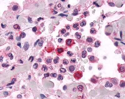 Immunohistochemistry-Paraffin: EMR2 Antibody [NLS6319] - Analysis of anti-EMR2 antibody with human lung, pneumonia, neutrophils.