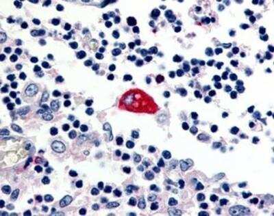 Immunohistochemistry-Paraffin: EMR3 Antibody [NBP1-02665] - Staining of human macrophage. Immunohistochemistry of formalin-fixed, paraffin-embedded tissue after heat-induced antigen retrieval. Antibody concentration 2.5 ug/ml.
