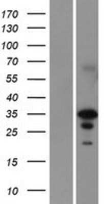 Western Blot: EN2 Overexpression Lysate (Adult Normal) [NBP2-08210] Left-Empty vector transfected control cell lysate (HEK293 cell lysate); Right -Over-expression Lysate for EN2.