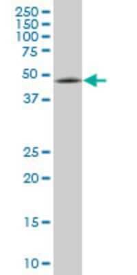 Western Blot: ENC1 Antibody (3C10) [H00008507-M03] - Analysis of ENC1 expression in IMR-32 (Cat # L008V1).