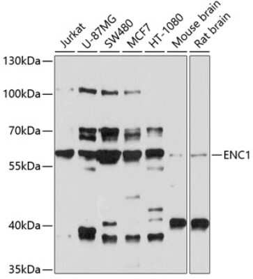 Western Blot: ENC1 Antibody [NBP3-04613] - Analysis of extracts of various cell lines, using ENC1 antibody at 1:1000 dilution. Secondary antibody: HRP Goat Anti-Rabbit IgG (H+L) at 1:10000 dilution. Lysates/proteins: 25ug per lane. Blocking buffer: 3% nonfat dry milk in TBST. Detection: ECL Basic Kit