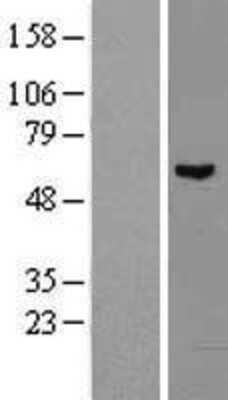 Western Blot: ENC1 Overexpression Lysate (Adult Normal) [NBL1-10263] Left-Empty vector transfected control cell lysate (HEK293 cell lysate); Right -Over-expression Lysate for ENC1.