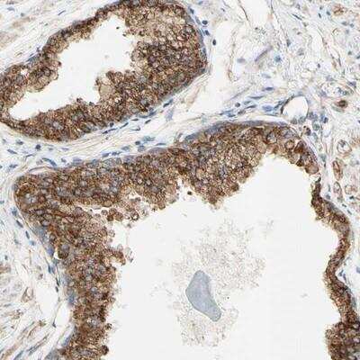 Immunohistochemistry-Paraffin ENDOD1 Antibody - BSA Free