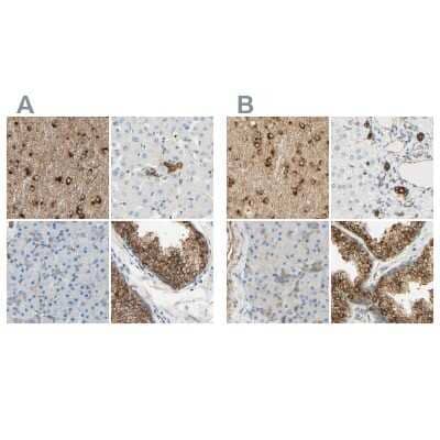 Immunohistochemistry-Paraffin ENDOD1 Antibody - BSA Free