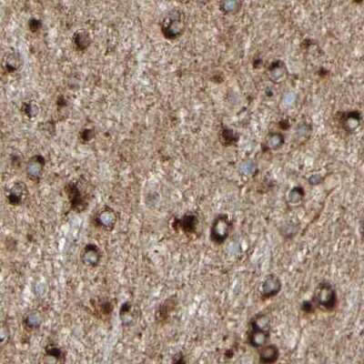 Immunohistochemistry-Paraffin ENDOD1 Antibody - BSA Free