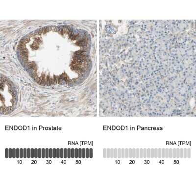 Immunohistochemistry-Paraffin ENDOD1 Antibody - BSA Free