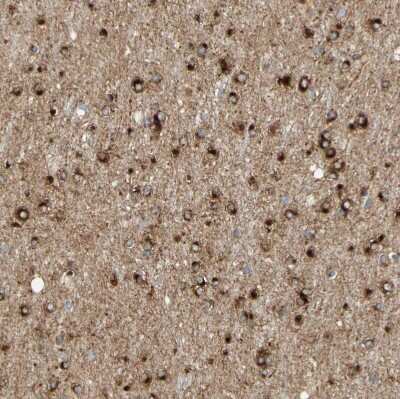 Immunohistochemistry-Paraffin ENDOD1 Antibody - BSA Free