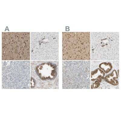 Immunohistochemistry-Paraffin ENDOD1 Antibody - BSA Free