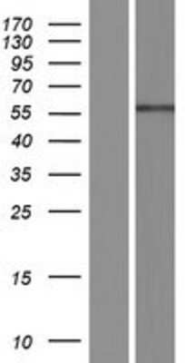 Western Blot ENDOD1 Overexpression Lysate