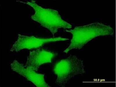 Immunocytochemistry/Immunofluorescence: ENO1P Antibody [H00002025-B01P] - Analysis of purified antibody to ENO1P on HeLa cell. (antibody concentration 10 ug/ml)