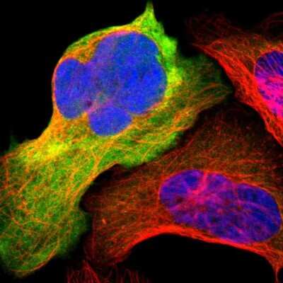 <b>Orthogonal Strategies Validation. </b>Immunocytochemistry/Immunofluorescence: ENO3 Antibody [NBP1-85821] - Staining of human cell line U-2 OS shows localization to plasma membrane and cytosol.