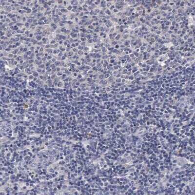 Immunohistochemistry-Paraffin: ENO3 Antibody [NBP1-85821] - Staining of human tonsil shows low expression as expected.