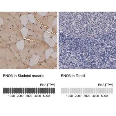Immunohistochemistry-Paraffin: ENO3 Antibody [NBP1-85821] - Staining in human skeletal muscle and tonsil tissues using anti-ENO3 antibody. Corresponding ENO3 RNA-seq data are presented for the same tissues.