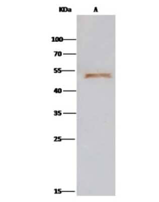 Immunoprecipitation: ENO3 Antibody [NBP3-00266] - ENO3 was immunoprecipitated using: Lane A: 0.5 mg HepG2 Whole Cell Lysate. 2 ul anti-ENO3 rabbit polyclonal antibody and 15 ul of 50 % Protein G agarose. Primary antibody: Anti-ENO3 rabbit polyclonal antibody, at 1:200 dilution. Secondary antibody: Clean-Bloto IP Detection Reagent (HRP) at 1:1000 dilution. Developed using the DAB staining technique. Performed under reducing conditions. Predicted band size: 47 kDa. Observed band size: 47 kDa