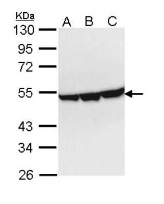 Western Blot: ENO3 Antibody [NBP1-31764] - Sample (30 ug of whole cell lysate) A: Hep G2 B: Molt-4 C: Raji 10% SDS PAGE; antibody diluted at 1:1000.