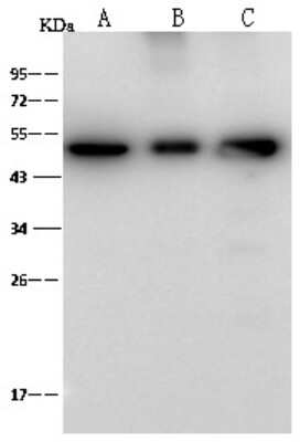 Western Blot: ENO3 Antibody [NBP2-99420] - Anti-ENO3 rabbit polyclonal antibody at 1:500 dilution. Lane A: HepG2 Whole Cell Lysate. Lane B: Molt-4 Whole Cell Lysate. Lane C: NIH-3T3 Whole Cell Lysate. Lysates/proteins at 30 ug per lane. Secondary Goat Anti-Rabbit IgG (H+L)/HRP at 1/10000 dilution. Developed using the ECL technique. Performed under reducing conditions. Predicted band size: 47 kDa. Observed band size: 47 kDa