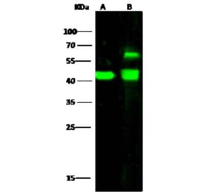 Western Blot: ENO3 Antibody [NBP3-00266] - Anti-ENO3 rabbit polyclonal antibody at 1:500 dilution. Lane A: HepG2 Whole Cell Lysate. Lane B: MOLT4 Whole Cell Lysate. Lysates/proteins at 30 ug per lane. Secondary Goat Anti-Rabbit IgG H&L (Dylight 800) at 1/10000 dilution. Developed using the Odyssey technique. Performed under reducing conditions. Predicted band size: 47 kDa. Observed band size: 47 kDa (We are unsure as to the identity of these extra bands).