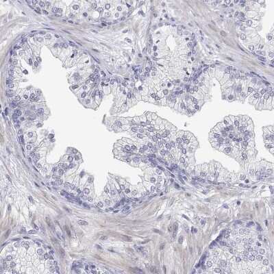Immunohistochemistry-Paraffin: ENO4 Antibody [NBP2-38927] - Staining of human prostate shows low expression as expected.