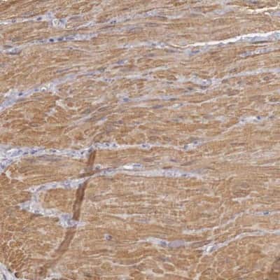 Immunohistochemistry-Paraffin: ENOX2 Antibody [NBP1-89038] - Staining of human smooth muscle shows strong cytoplasmic positivity in smooth muscle cells.