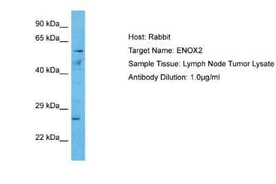 Western Blot: ENOX2 Antibody [NBP2-84855] - WB Suggested Anti-ENOX2 antibody Titration: 1 ug/mL. Sample Type: Human Lymph Node Tumor