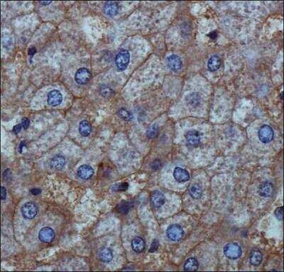 Immunohistochemistry-Paraffin: ENPP-1 Antibody [NB600-816] - ENPP1 Antibody [NB600-816] -  ENPP1 antibody was tested in human liver using DAB with hematoxylin counterstain.