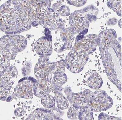 Immunohistochemistry-Paraffin: ENPP-1 Antibody [NBP2-38945] - Staining of human placenta shows cytoplasmic positivity in stromal cells.