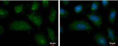 Immunocytochemistry/Immunofluorescence: ENPP-2/Autotaxin Antibody [NBP2-16339] -  NT2D1 cells were fixed in ice-cold MeOH for 5 min. Green: Autotaxin protein stained by Autotaxin antibody  diluted at 1:500. Blue: Hoechst 33342 staining.