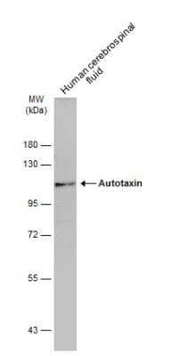 Western Blot: ENPP-2/Autotaxin Antibody [NBP2-16339] - Human cerebrospinal fluid (30 ug) was separated by 7.5% SDS-PAGE, and the membrane was blotted with Autotaxin antibody diluted at 1:500. The HRP-conjugated anti-rabbit IgG antibody (NBP2-19301) was used to detect the primary antibody.